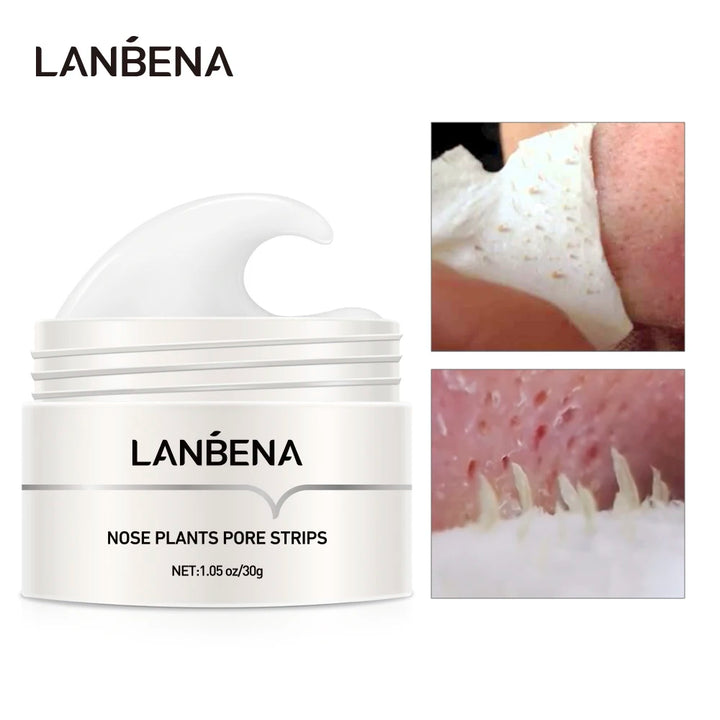 Lanbena Blackhead Remover Nose Mask